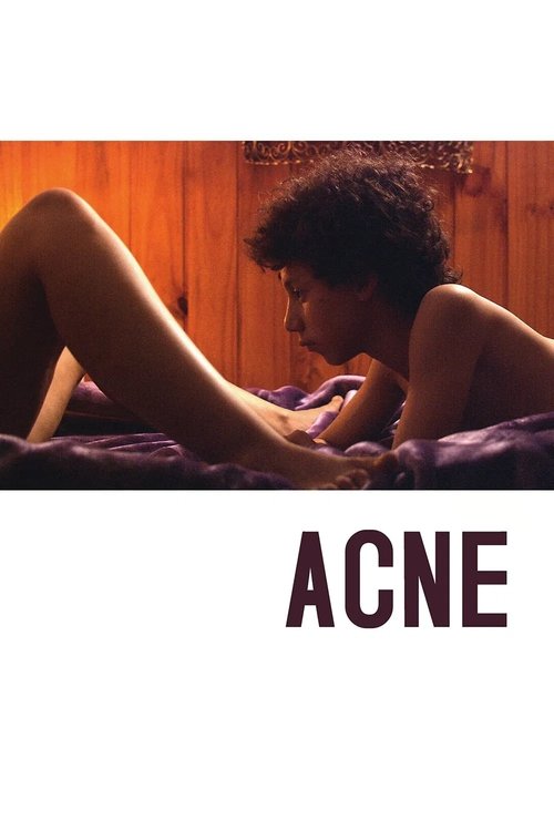 Acné poster
