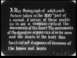 Macintyre's X-Ray Film poster