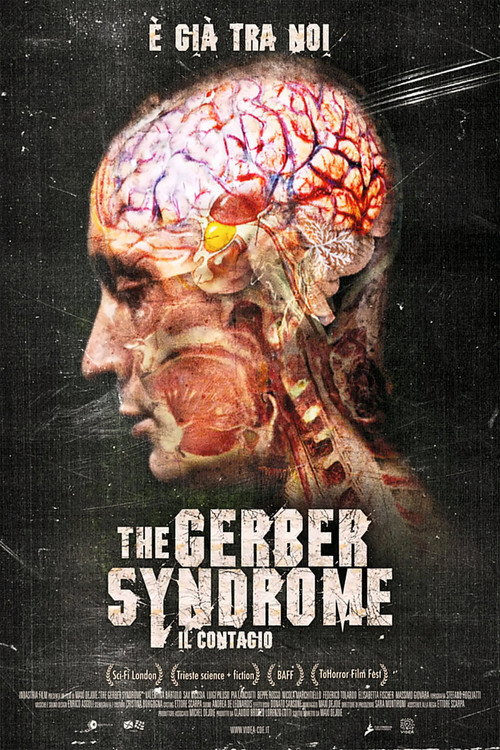 The Gerber Syndrome poster