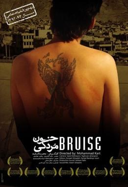خونمردگی poster